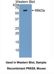 https://msimg.bioon.com/bionline/goods-no-pic.png