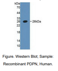 https://msimg.bioon.com/bionline/goods-no-pic.png