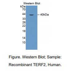 人端粒重复结合因子2(TERF2)多克隆抗体
