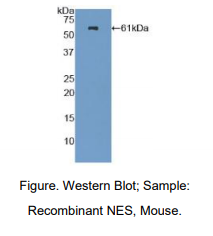 https://msimg.bioon.com/bionline/goods-no-pic.png