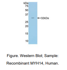 人肌球蛋白重链14(MYH14)多克隆抗体