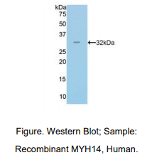 https://msimg.bioon.com/bionline/goods-no-pic.png