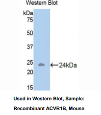 https://msimg.bioon.com/bionline/goods-no-pic.png