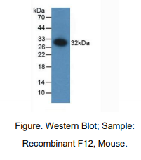 小鼠凝血因子Ⅻ(F12)多克隆抗体