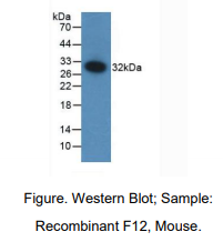 https://msimg.bioon.com/bionline/goods-no-pic.png