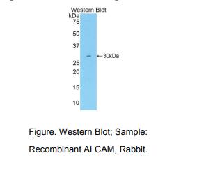 兔白细胞激活黏附因子(ALCAM)多克隆抗体