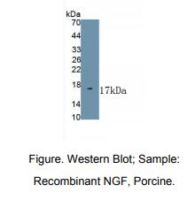 猪神经生长因子(NGF)多克隆抗体