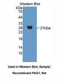 https://msimg.bioon.com/bionline/goods-no-pic.png