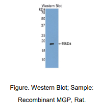 大鼠基质Gla蛋白(MGP)多克隆抗体
