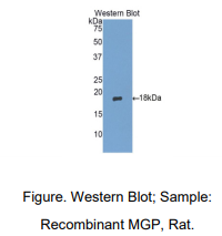 https://msimg.bioon.com/bionline/goods-no-pic.png