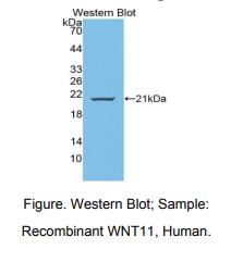 https://msimg.bioon.com/bionline/goods-no-pic.png