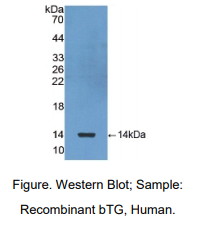 https://msimg.bioon.com/bionline/goods-no-pic.png