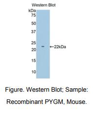 小鼠糖原磷酸化酶M(PYGM)多克隆抗体