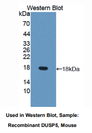 小鼠双特异性磷酸酶5(DUSP5)多克隆抗体