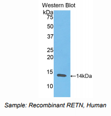 https://msimg.bioon.com/bionline/goods-no-pic.png