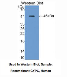 https://msimg.bioon.com/bionline/goods-no-pic.png