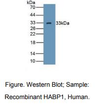 https://msimg.bioon.com/bionline/goods-no-pic.png