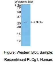 人磷酯酶Cγ1(PLCg1)多克隆抗体