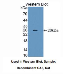 https://msimg.bioon.com/bionline/goods-no-pic.png