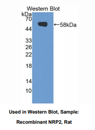 https://msimg.bioon.com/bionline/goods-no-pic.png