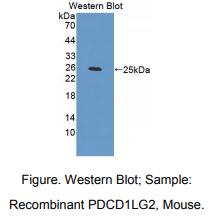 https://msimg.bioon.com/bionline/goods-no-pic.png