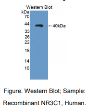 https://msimg.bioon.com/bionline/goods-no-pic.png