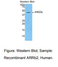 人抑制蛋白β2(ARRb2)多克隆抗体