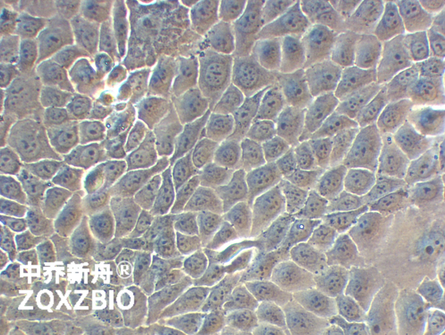 人甲状腺癌细胞