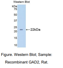 https://msimg.bioon.com/bionline/goods-no-pic.png