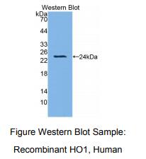 https://msimg.bioon.com/bionline/goods-no-pic.png