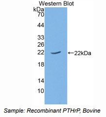 牛甲状旁腺激素相关蛋白(PTHrP)多克隆抗体