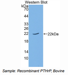 https://msimg.bioon.com/bionline/goods-no-pic.png