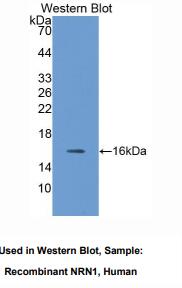 人神经突蛋白1(NRN1)多克隆抗体