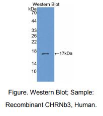 https://msimg.bioon.com/bionline/goods-no-pic.png