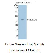 大鼠血小板膜糖蛋白Ⅳ(CD36)多克隆抗体