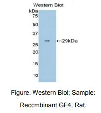 https://msimg.bioon.com/bionline/goods-no-pic.png