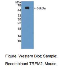 https://msimg.bioon.com/bionline/goods-no-pic.png