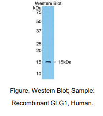 https://msimg.bioon.com/bionline/goods-no-pic.png