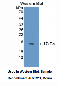 https://msimg.bioon.com/bionline/goods-no-pic.png