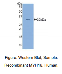 https://msimg.bioon.com/bionline/goods-no-pic.png