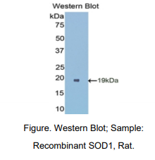 大鼠超氧化物歧化酶1(SOD1)多克隆抗体