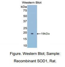 https://msimg.bioon.com/bionline/goods-no-pic.png