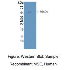 https://msimg.bioon.com/bionline/goods-no-pic.png