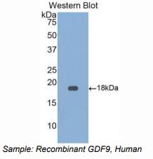 人生长分化因子9(GDF9)多克隆抗体