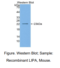 https://msimg.bioon.com/bionline/goods-no-pic.png