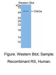 人视网膜劈裂蛋白(RS)多克隆抗体