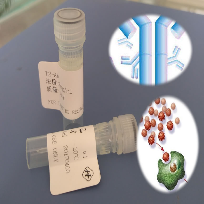 https://img.medsci.cn/ddcde1e7b2e0e108e468875510e7fab63610d4f3ca7f516c873b77eef8605285.jpg