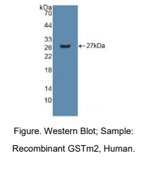 人谷胱甘肽S转移酶μ2(GSTM2)多克隆抗体