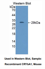 小鼠晶状体蛋白βA1(CRYbA1)多克隆抗体