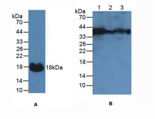 https://msimg.bioon.com/bionline/goods-no-pic.png